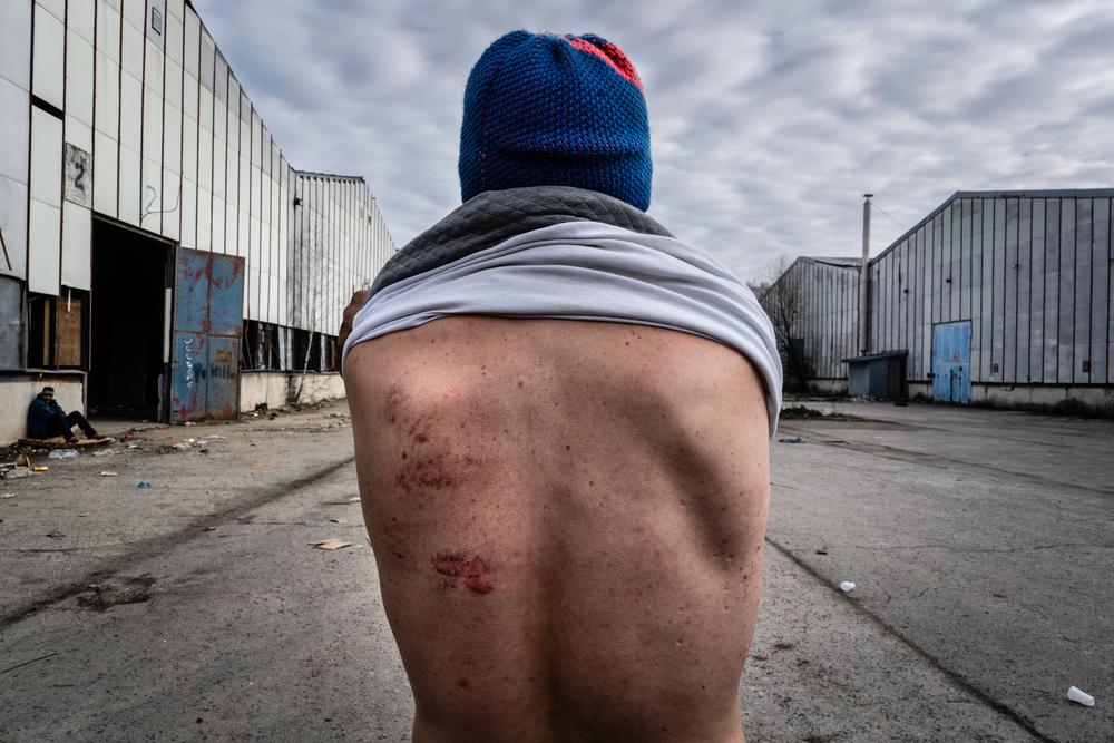 MSF, Doctors Without Borders, Refugees, Bosnia