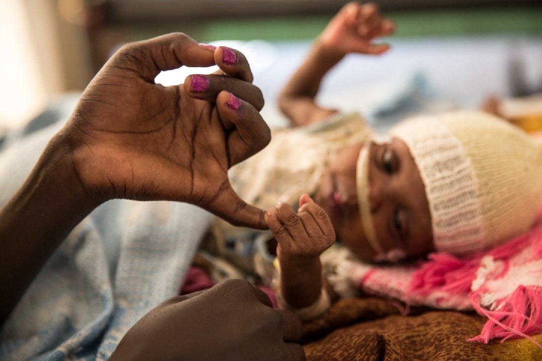 3 Malakal South Sudan - Anna Surinyachmsf