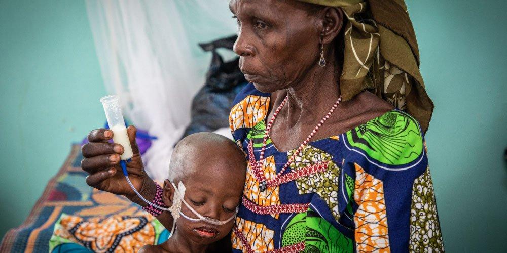 A-patient-is-eating-through-a-nasogastric-tube