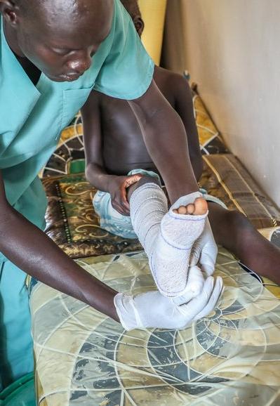 A patient's leg is being bandaged after a snake bite.