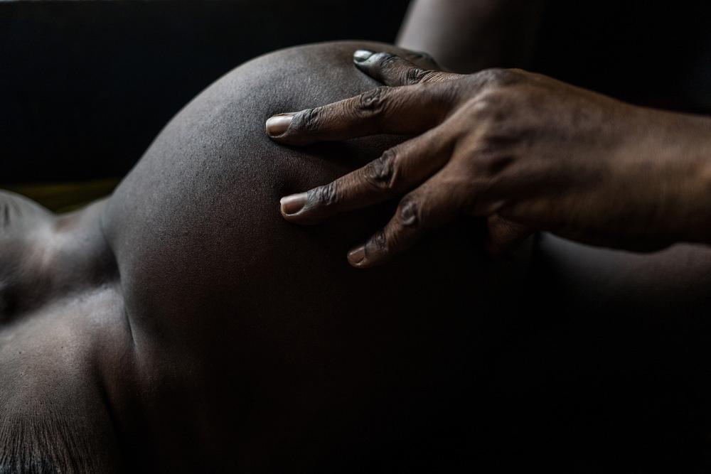 MSF mobile clinics - Nzacko, Central African Republic MSF, Doctors Without Borders, A year in Pictures 2021