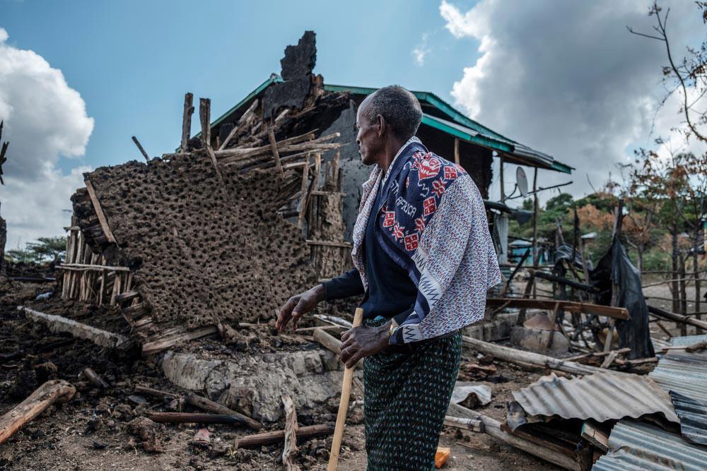 Tigray Fighting Consequences on Population MSF, Doctors Without Borders, A year in Pictures 2021