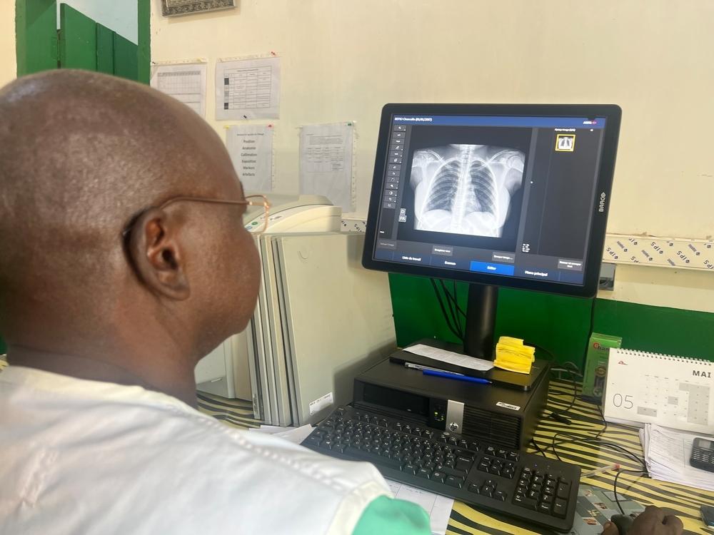 AI tuberculosis screening Central African Republic