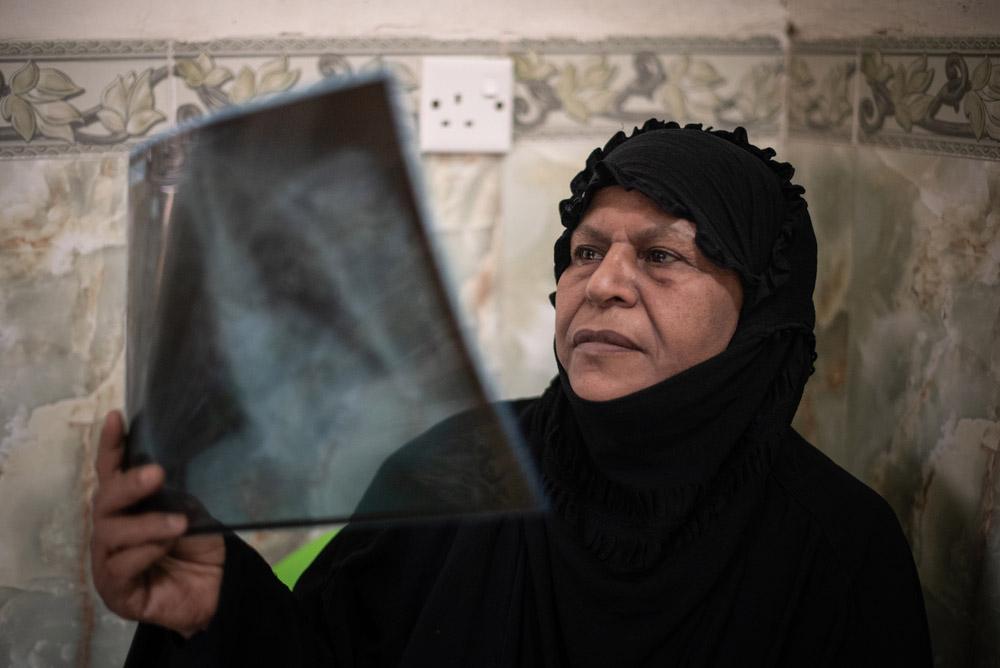 Tackling multidrug-resistant tuberculosis, one patient at a time in Iraq MSF, Doctors Without Borders, A year in Pictures 2021
