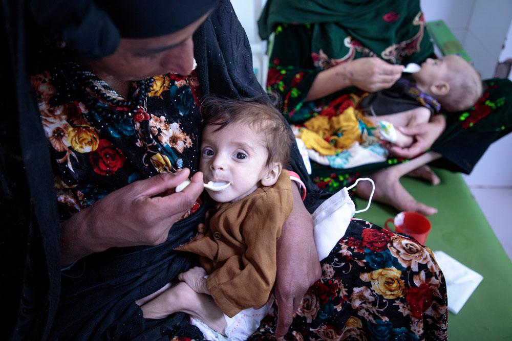 Inpatient Therapeutic Feeding Centre (ITFC) at Herat Regional Hospital, Afghanistan MSF, Doctors Without Borders, A year in Pictures 2021