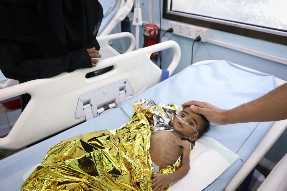 A 7 month old baby in hospital for acute malnutrition in Yemen