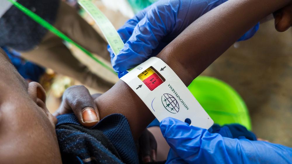 Baidoa child malnutrition survey