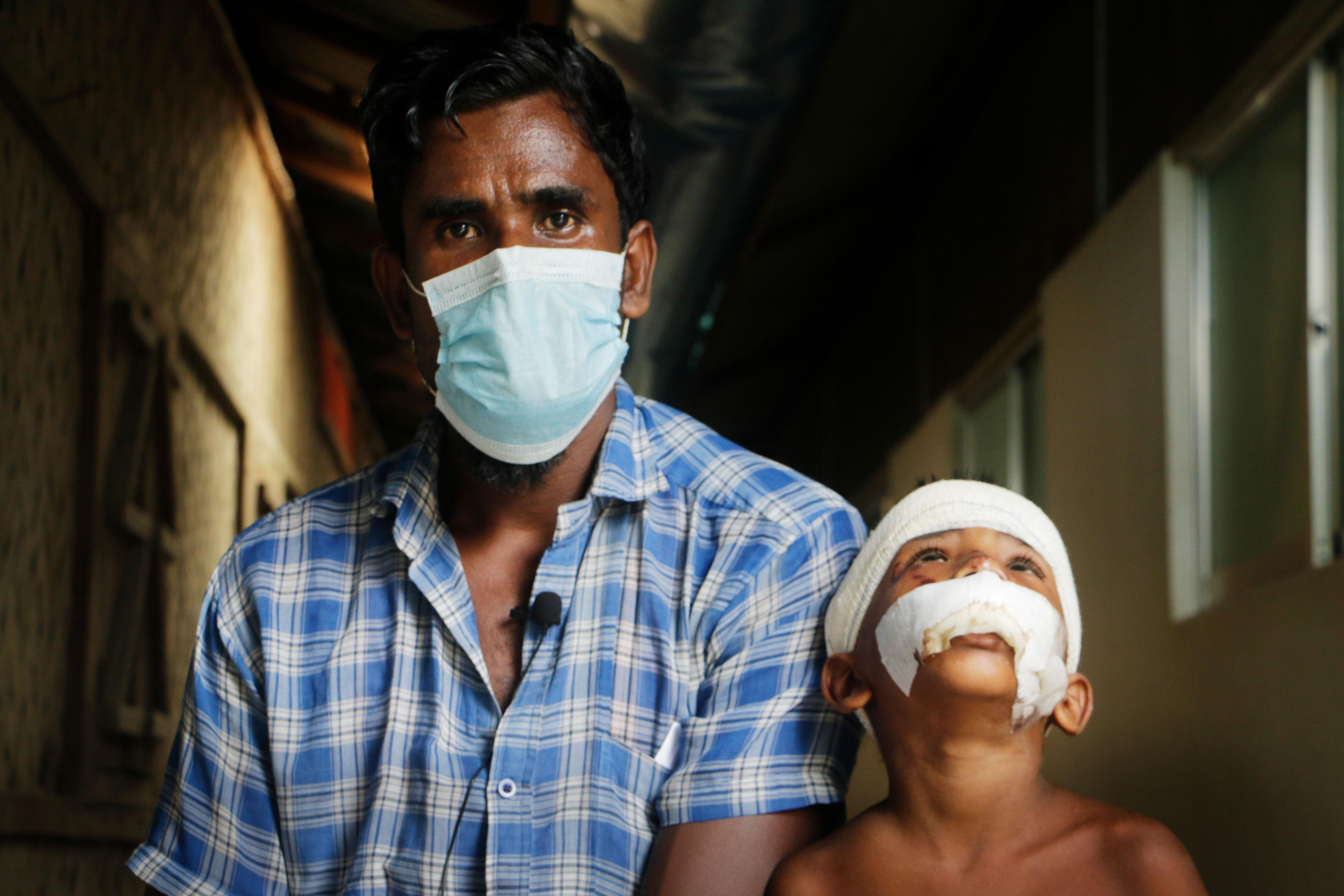 Father and son who are patients at MSF’s Kutupalong hospital in Bangladesh