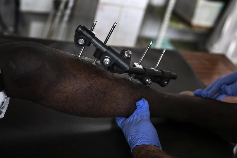 MSF, Doctors Without Borders, Cameroon, Suspension of activities and teams