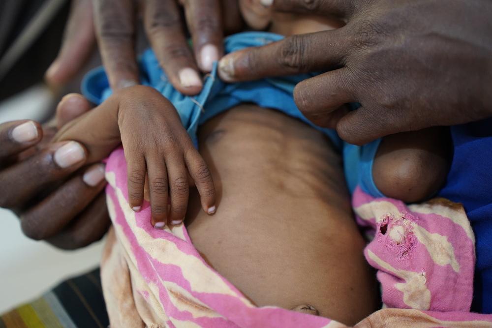 MSF, Doctors Without Borders, Funding gaps, Somalia, Women and Children