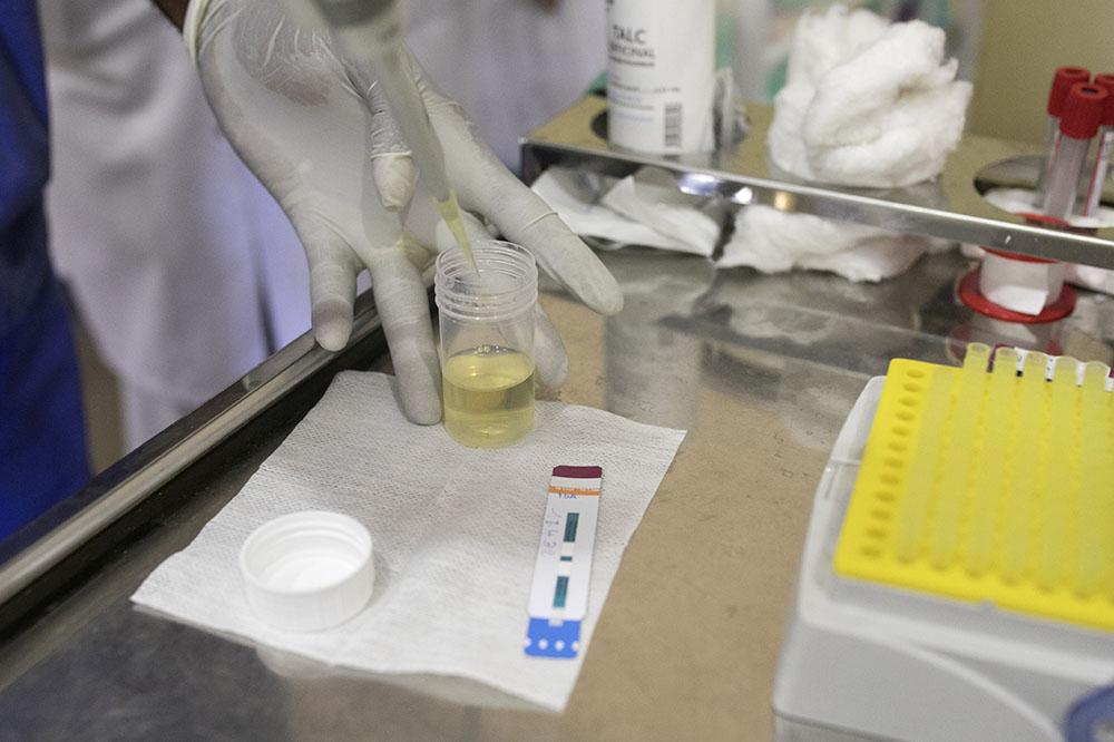 test using a patients’ urine to test the presence of TB in a severely ill AIDS patient.