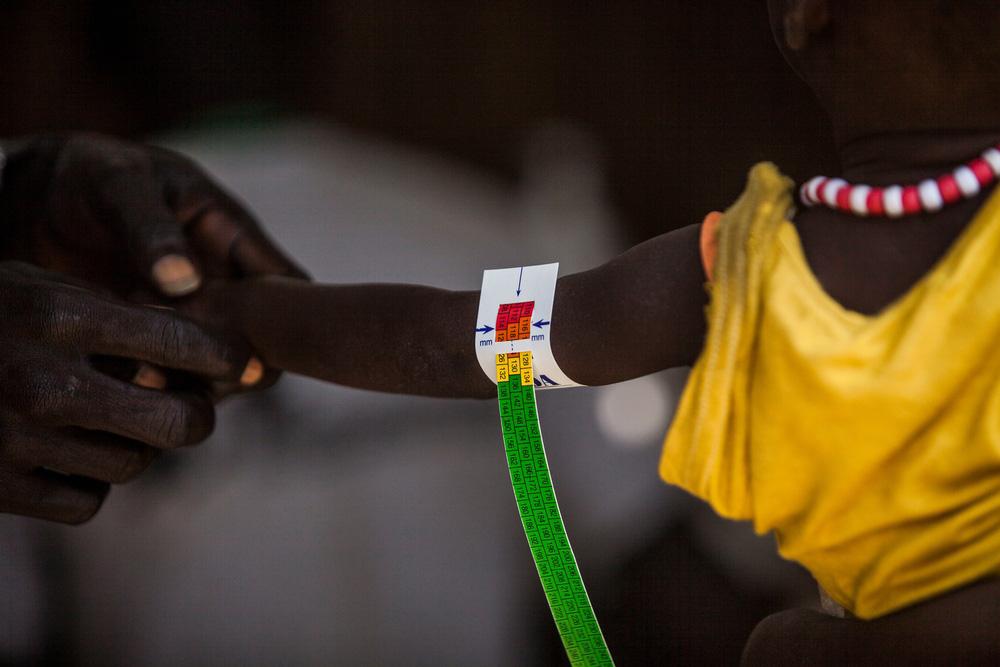 MSF, Doctors Without Borders, our activities in South Sudan 