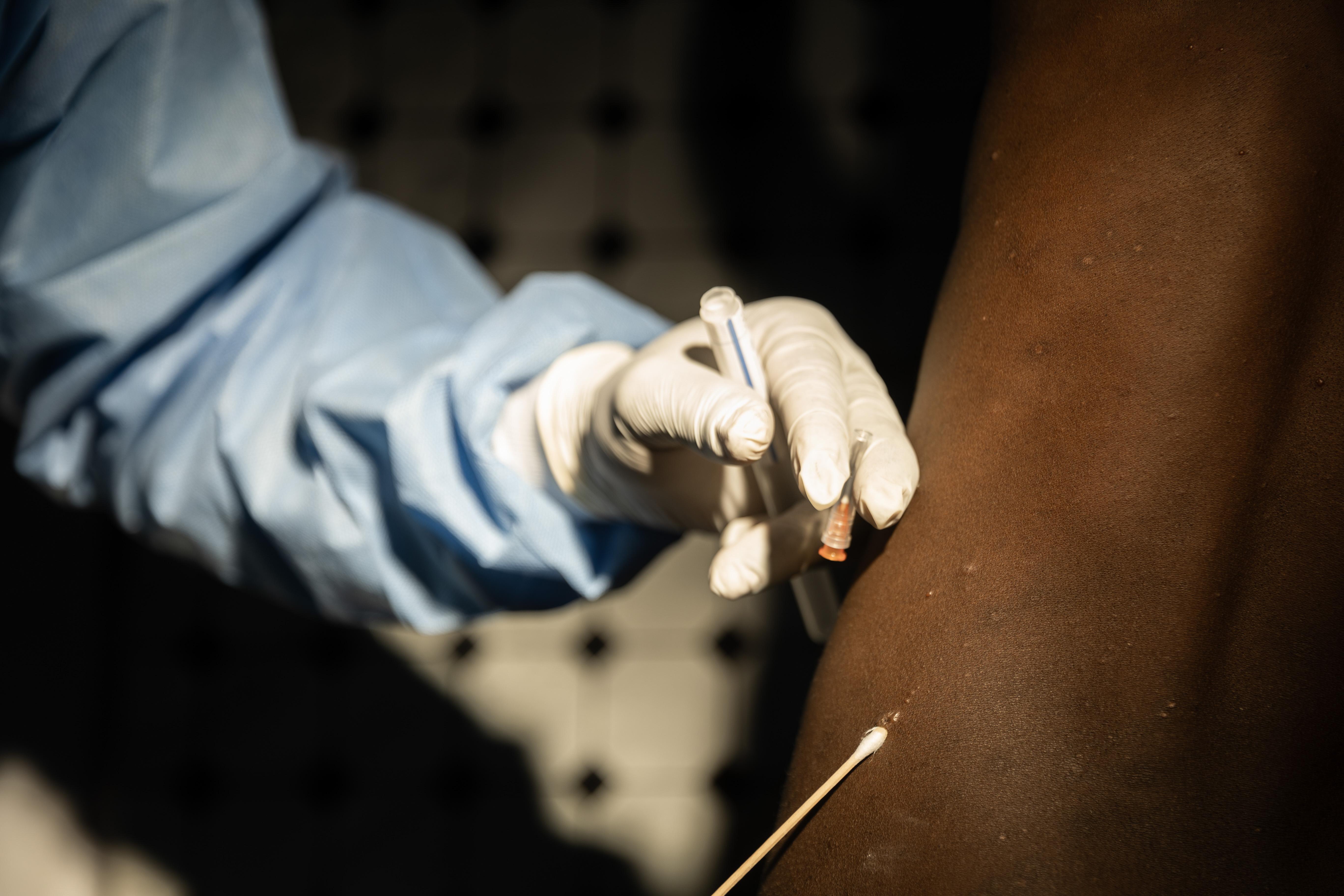 MSF, Doctors Without Borders, MSF activities in the Democratic Republic of Congo