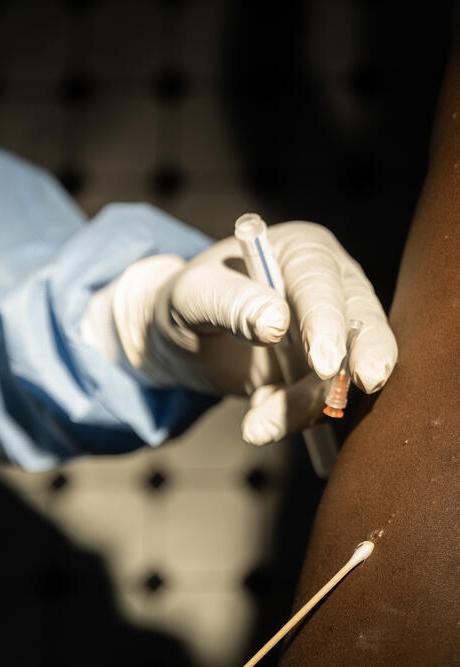 A doctor screens a patient's back for mpox.