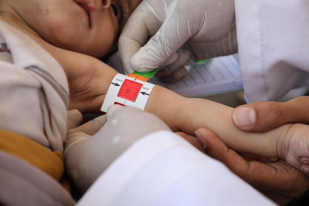 Grave health crisis as measles cases surge in Yemen