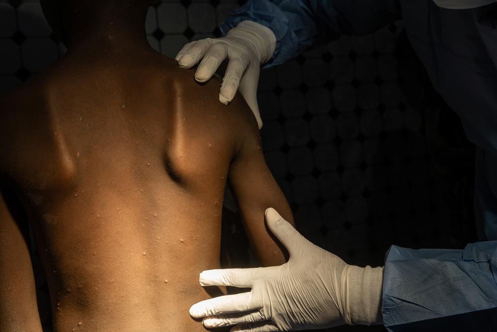 A patient's back is being examined by a doctor.