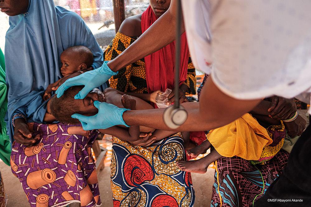 Doctor treating a child in Shinkafi General Hospital, Zamfara state, Nigeria. 