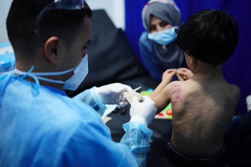 MSF, Doctors Without Borders, Burn care n Gaza, Palestine