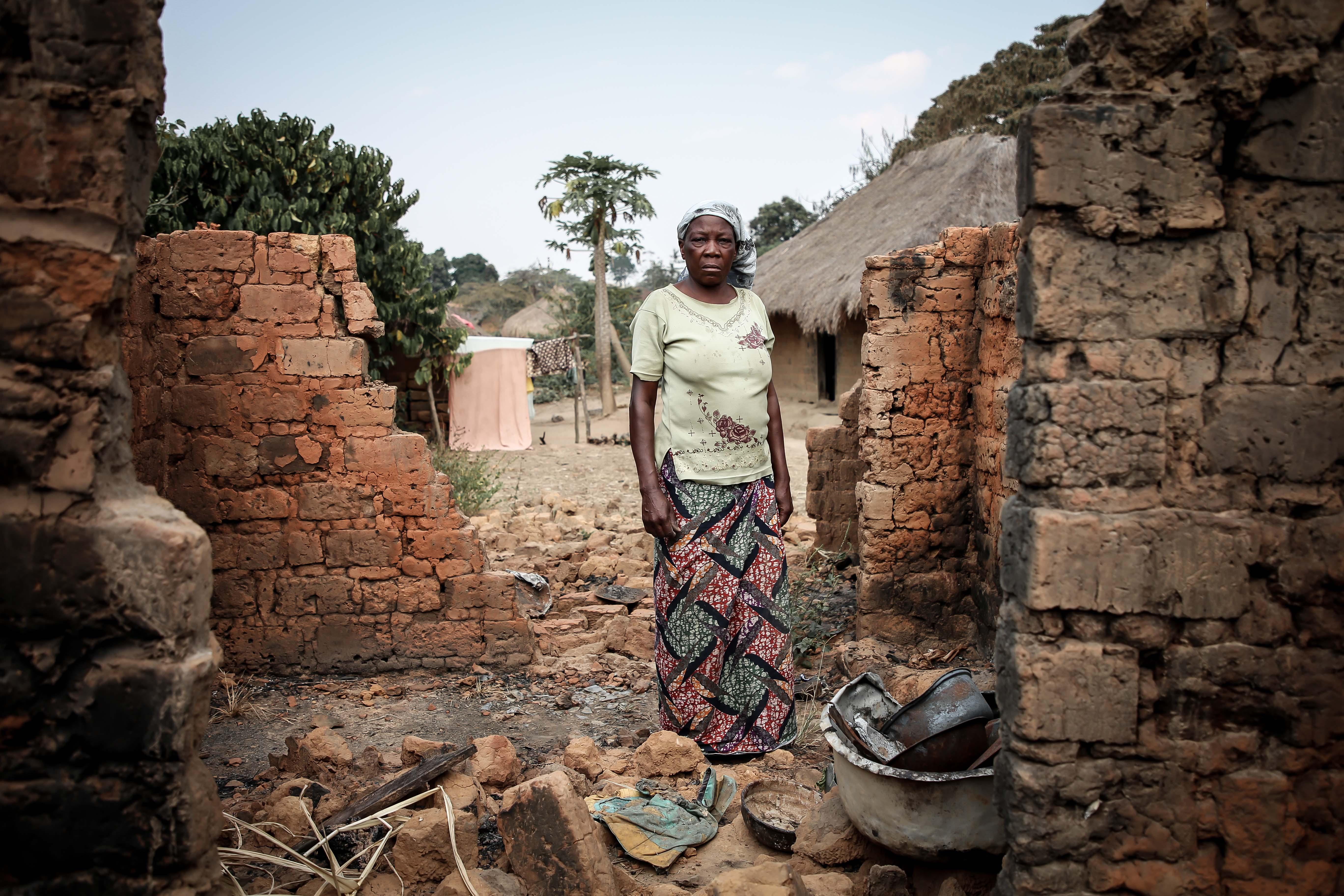 Patient S., who returned to her village of Katumbutele to find her house burnt down.