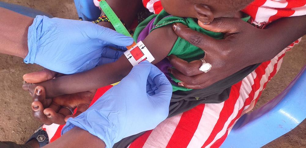MSF Nurse measuring the Mid-Upper Arm Circumference (MUAC) of a child 