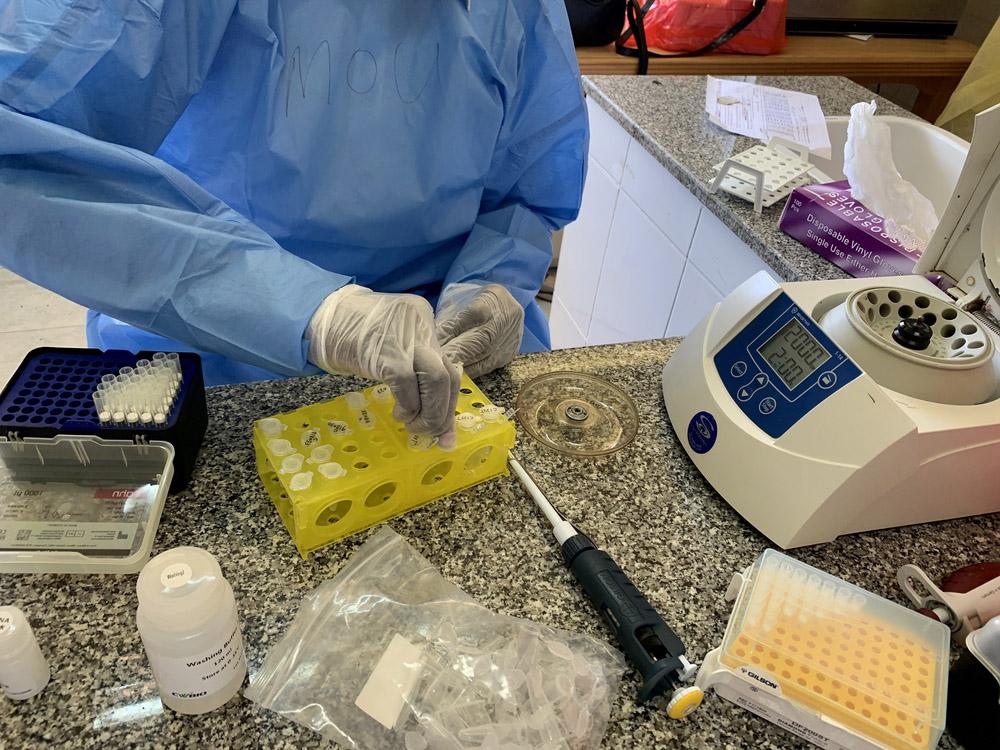 Lab technician fixing samples in South Sudan