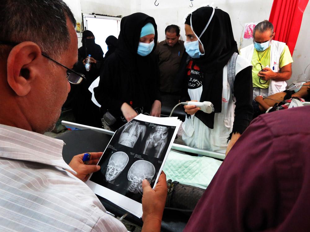 A picture of healthcare workers looking at scans at Abs Hospital in Yemen