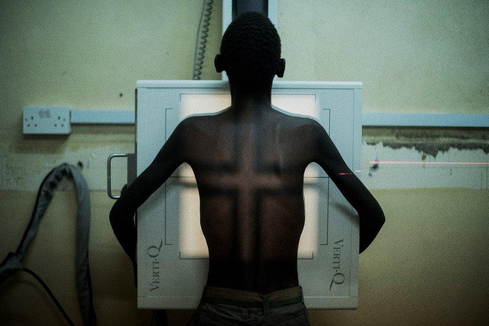 Msf203682 Malawi Hiv