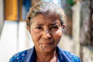 MSF, Doctors Without Borders, Rohingya in Myanmar mental health