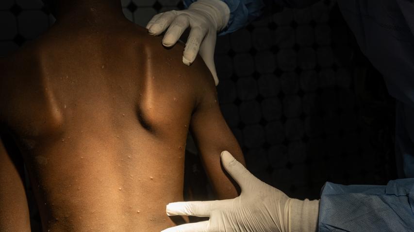 A patient's back is being examined by a doctor.