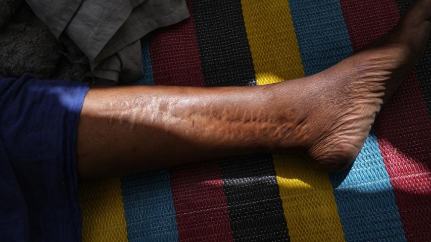 Doctors Without Borders, MSF, Two years of war in Sudan